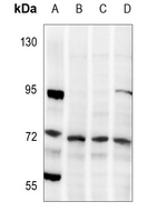 1 - Anti-LIMK1/2 (Phospho-T508/505) Antibody AP59607