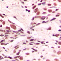 19 - Anti-LMX1B Antibody AP59609