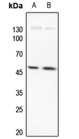 1 - Anti-LMX1B Antibody AP59609