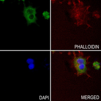 3 - Anti-TNF beta Antibody AP59610