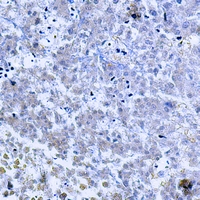 19 - Anti-TNF beta Antibody AP59610