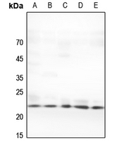 1 - Anti-TNF beta Antibody AP59610