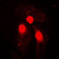 3 - Anti-SMAD3 (Phospho-S204) Antibody AP59615