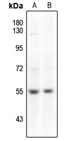 1 - Anti-SMAD3 (Phospho-S204) Antibody AP59615