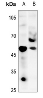 1 - Anti-TAU (Phospho-T548) Antibody AP59618