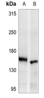 1 - Anti-ASK1 Antibody AP59621