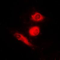 3 - Anti-FOXO4 (Phospho-S197) Antibody AP59622