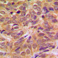 19 - Anti-FOXO4 (Phospho-S197) Antibody AP59622