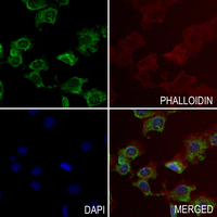3 - Anti-MMP7 Antibody AP59623