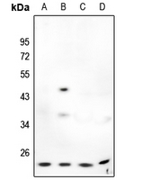 1 - Anti-MMP7 Antibody AP59623