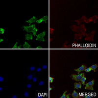 3 - Anti-MMP12 Antibody AP59624