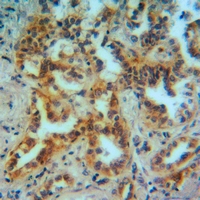 19 - Anti-MMP12 Antibody AP59624