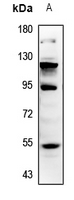 1 - Anti-MMP12 Antibody AP59624