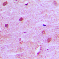 19 - Anti-MNAT1 Antibody AP59625