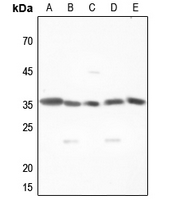 1 - Anti-MNAT1 Antibody AP59625