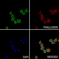 3 - Anti-Myotubularin Antibody AP59627