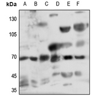 1 - Anti-Myotubularin Antibody AP59627