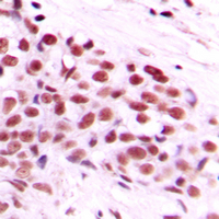 19 - Anti-c-Myc (Phospho-T58) Antibody AP59629