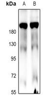 1 - Anti-MLCK1 Antibody AP59630