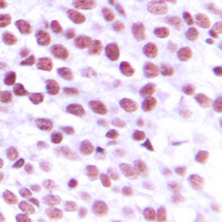 19 - Anti-Nibrin Antibody AP59631