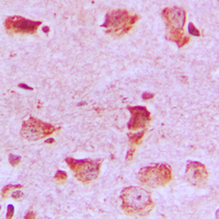 19 - Anti-NDUFA8 Antibody AP59632
