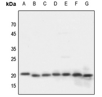 1 - Anti-NDUFA8 Antibody AP59632