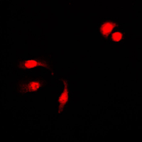 3 - Anti-NF-kappaB p105 (Phospho-S927) Antibody AP59635