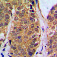 19 - Anti-NF-kappaB p105 (Phospho-S927) Antibody AP59635