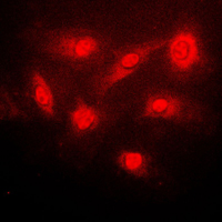 3 - Anti-IKB beta (Phospho-S23) Antibody AP59637
