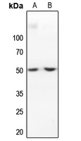 1 - Anti-IKB beta Antibody AP59638