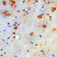 19 - Anti-nm23-H1 Antibody AP59641