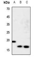 1 - Anti-nm23-H1 Antibody AP59641