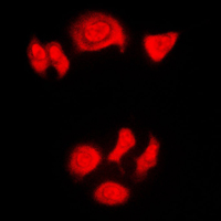 3 - Anti-Nucleophosmin (Phospho-T199) Antibody AP59642