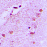 19 - Anti-Nucleophosmin (Phospho-T199) Antibody AP59642