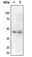 1 - Anti-Nucleophosmin (Phospho-T199) Antibody AP59642