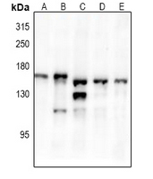 1 - Anti-TRK B (Phospho-Y516) Antibody AP59644