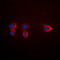 3 - Anti-TRK B Antibody AP59645