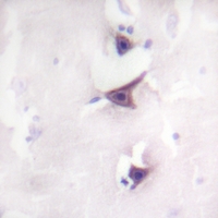 19 - Anti-TRK B Antibody AP59645