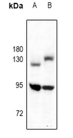 1 - Anti-TRK B Antibody AP59645