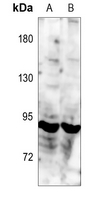 1 - Anti-TRK C Antibody AP59646