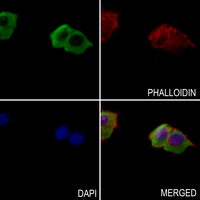 3 - Anti-OCRL Antibody AP59647