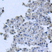 19 - Anti-OCRL Antibody AP59647
