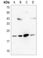 1 - Anti-RKIP Antibody [KO/KD Validated] AP59648
