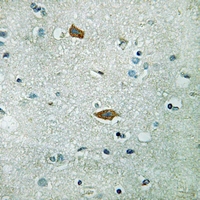 19 - Anti-PAI2 Antibody AP59650