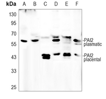 1 - Anti-PAI2 Antibody AP59650