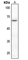 1 - Anti-PAK2 (Phospho-S20) Antibody AP59651