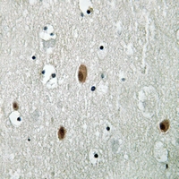 19 - Anti-PAK3 (Phospho-S154) Antibody AP59652