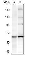 1 - Anti-PAK3 (Phospho-S154) Antibody AP59652
