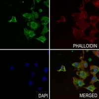3 - Anti-PDGFA Antibody AP59654
