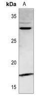 1 - Anti-PDGFA Antibody AP59654